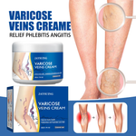 Charger l'image dans la galerie, Crème anti-varices – Éliminez les varices et redonnez vie à vos jambes naturellement