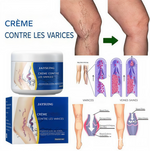 Charger l'image dans la galerie, Crème anti-varices – Éliminez les varices et redonnez vie à vos jambes naturellement
