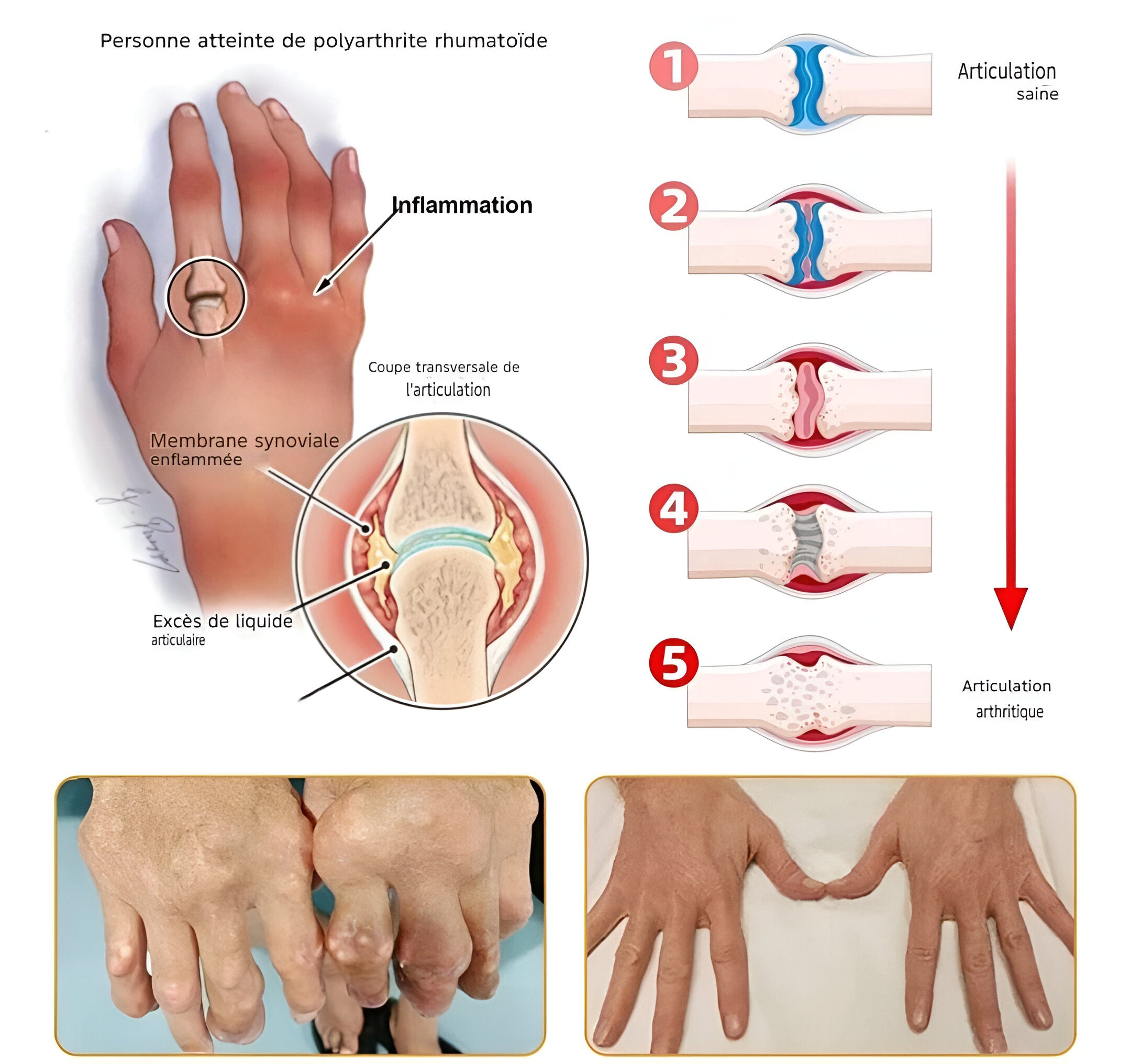 Crème Miracle – Fini les douleurs, raideurs et gonflements dès la première application !