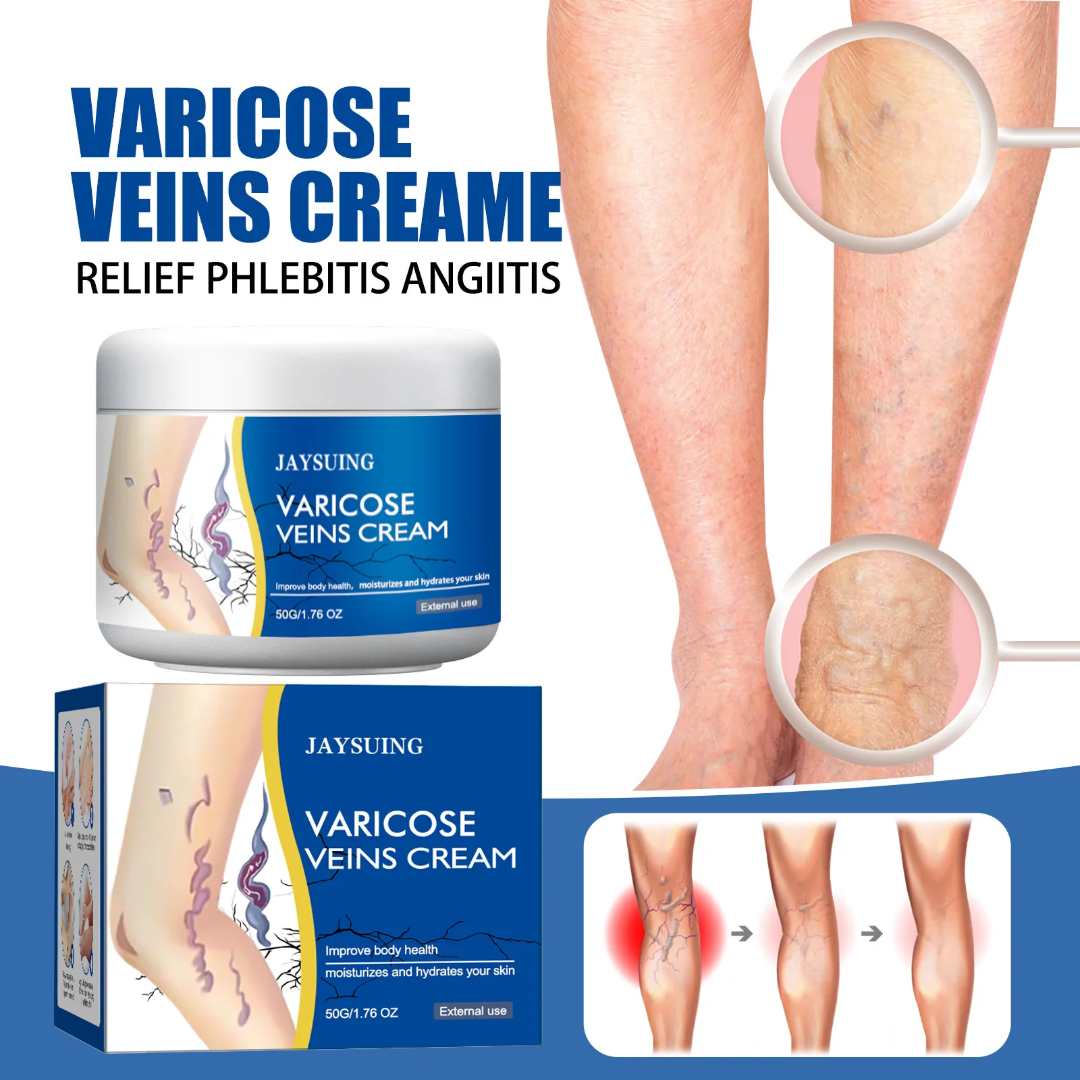 Crème anti-varices – Éliminez les varices et redonnez vie à vos jambes naturellement