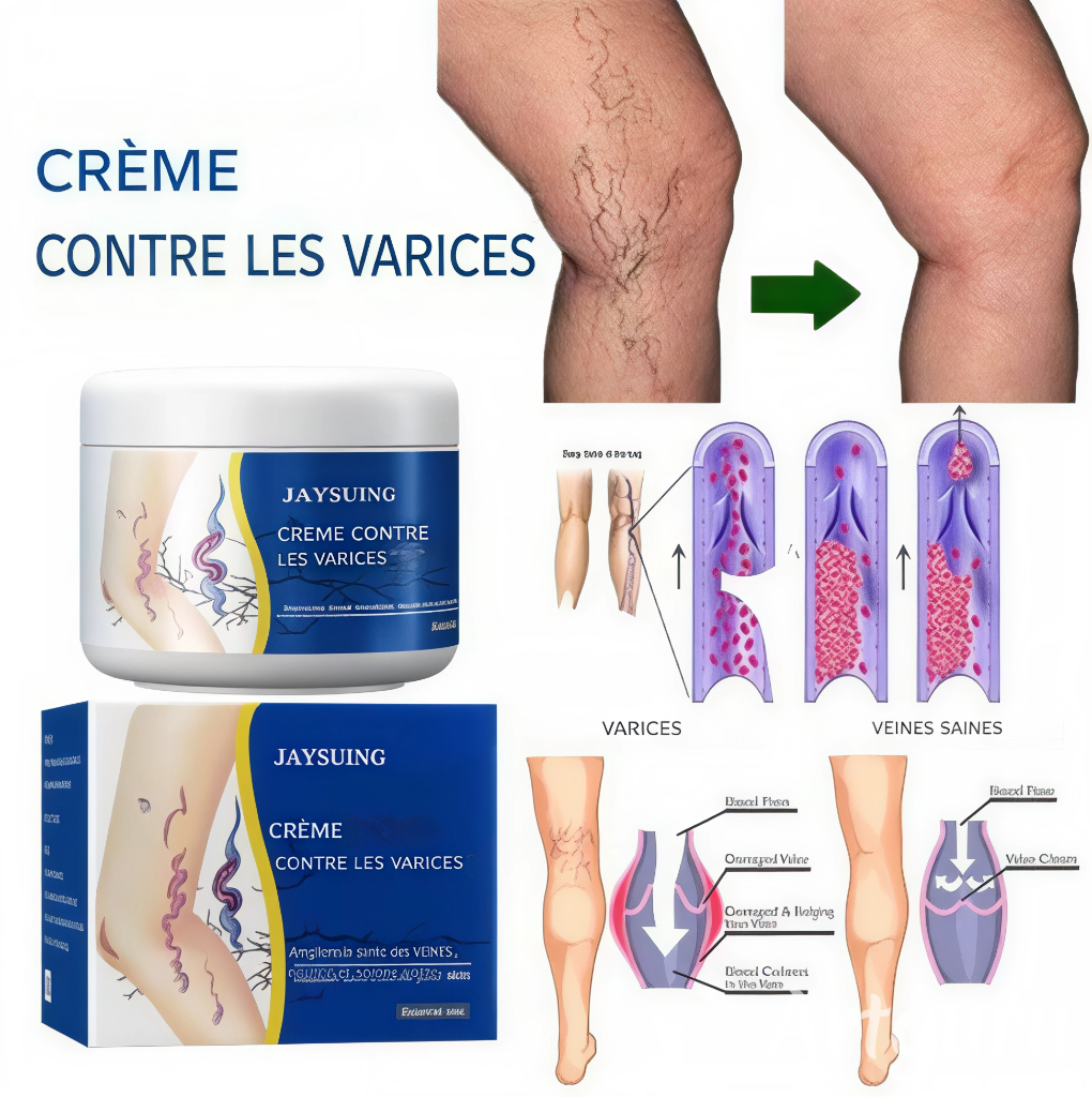 Crème anti-varices – Éliminez les varices et redonnez vie à vos jambes naturellement